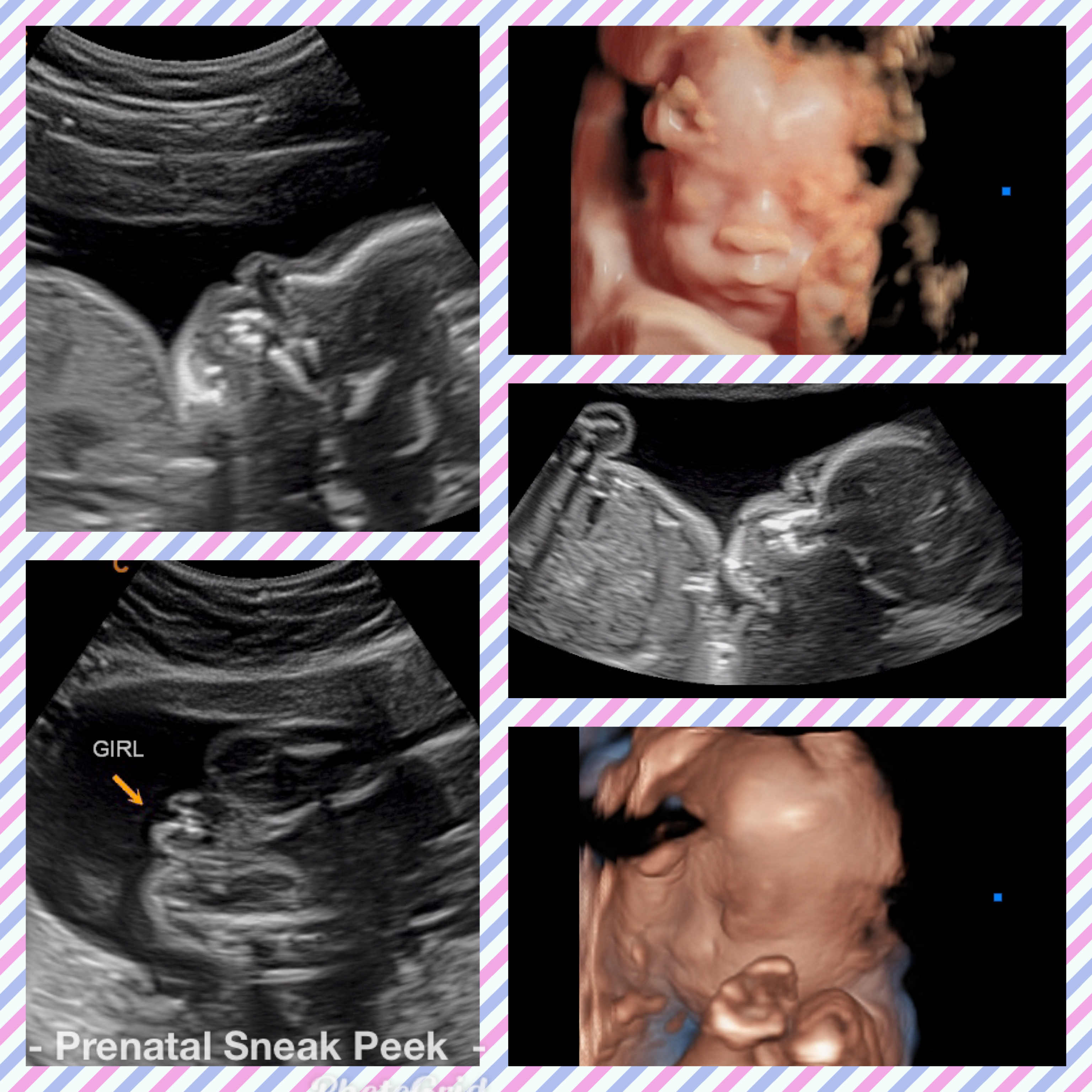 20200504_041922000_iOS