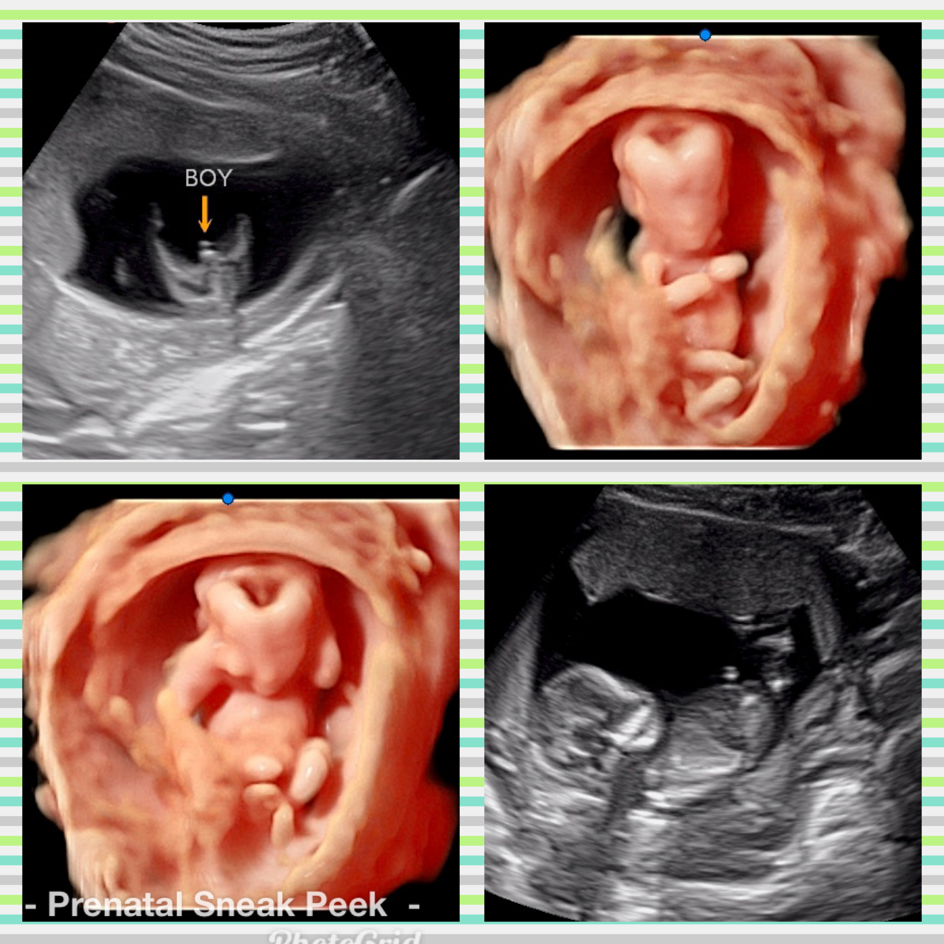 20200504_042514000_iOS