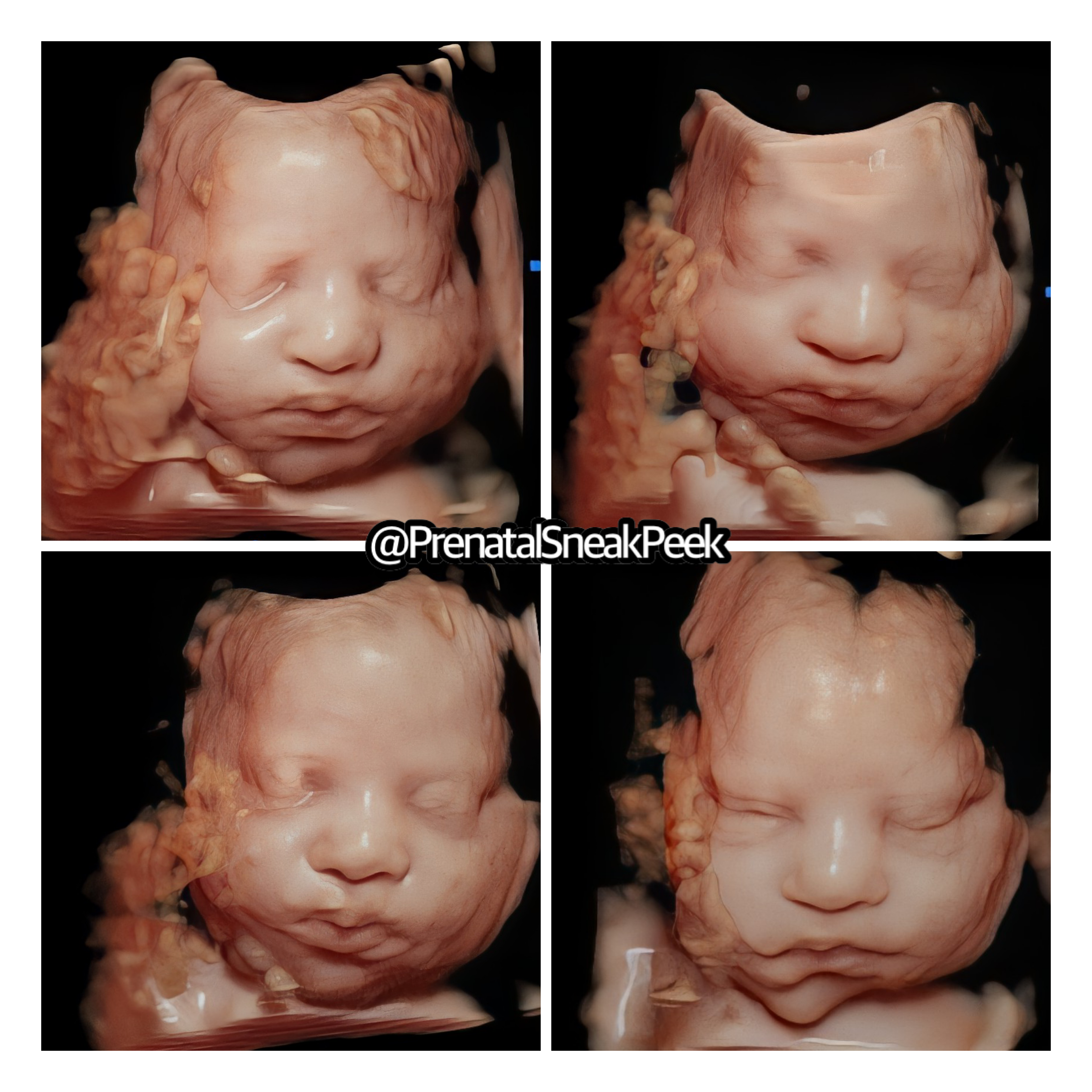 20220227_005402000_iOS