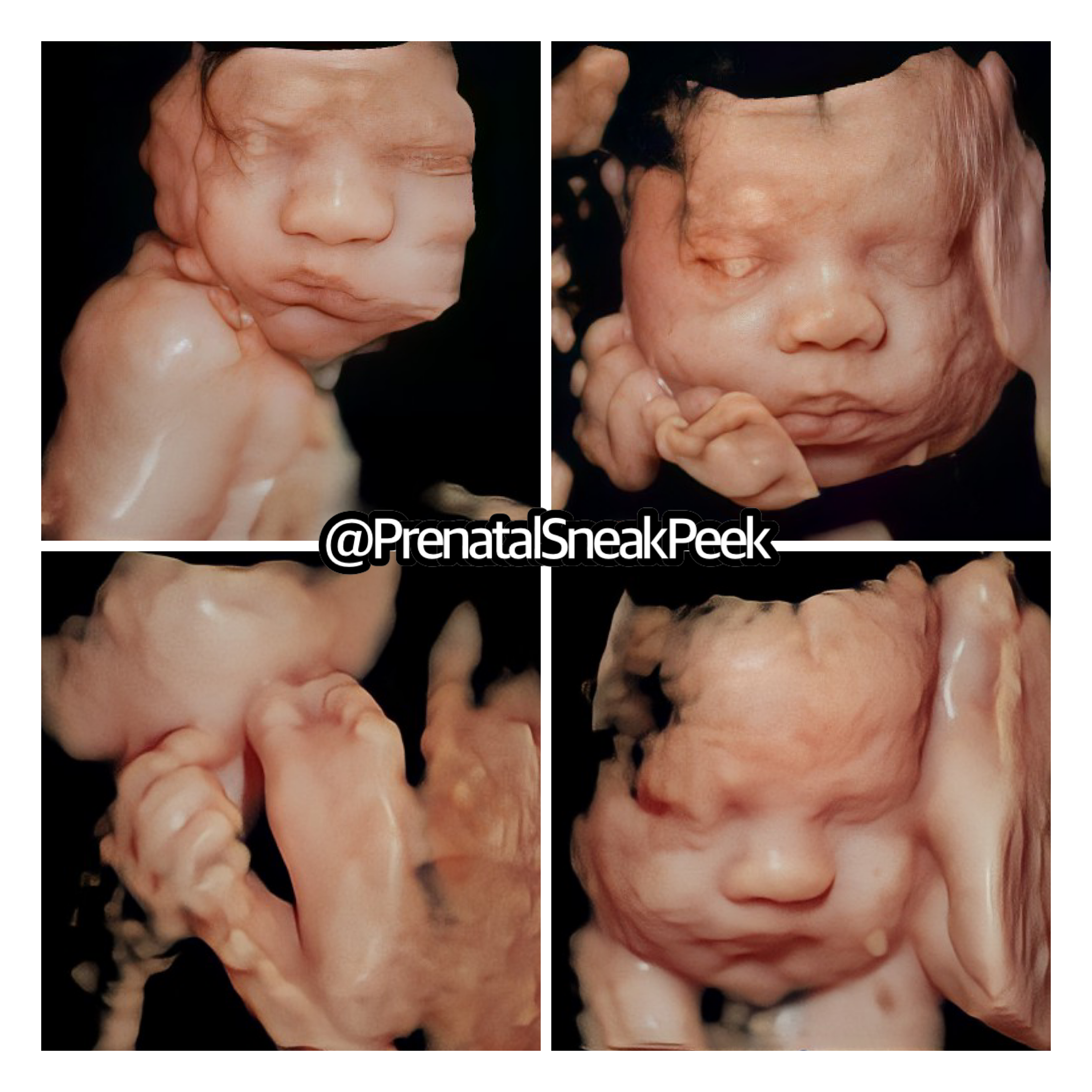 20220227_010136000_iOS