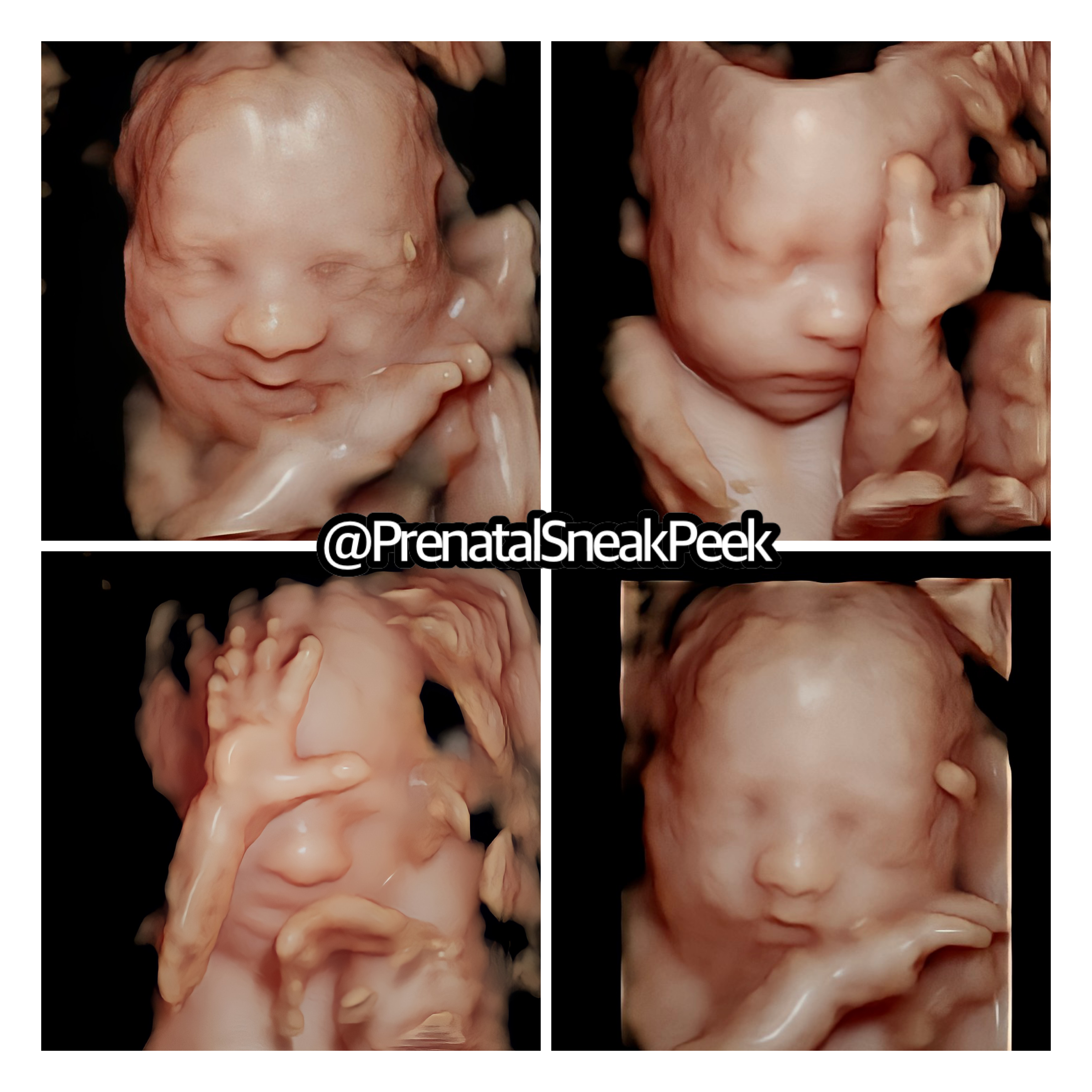 20220227_010250000_iOS