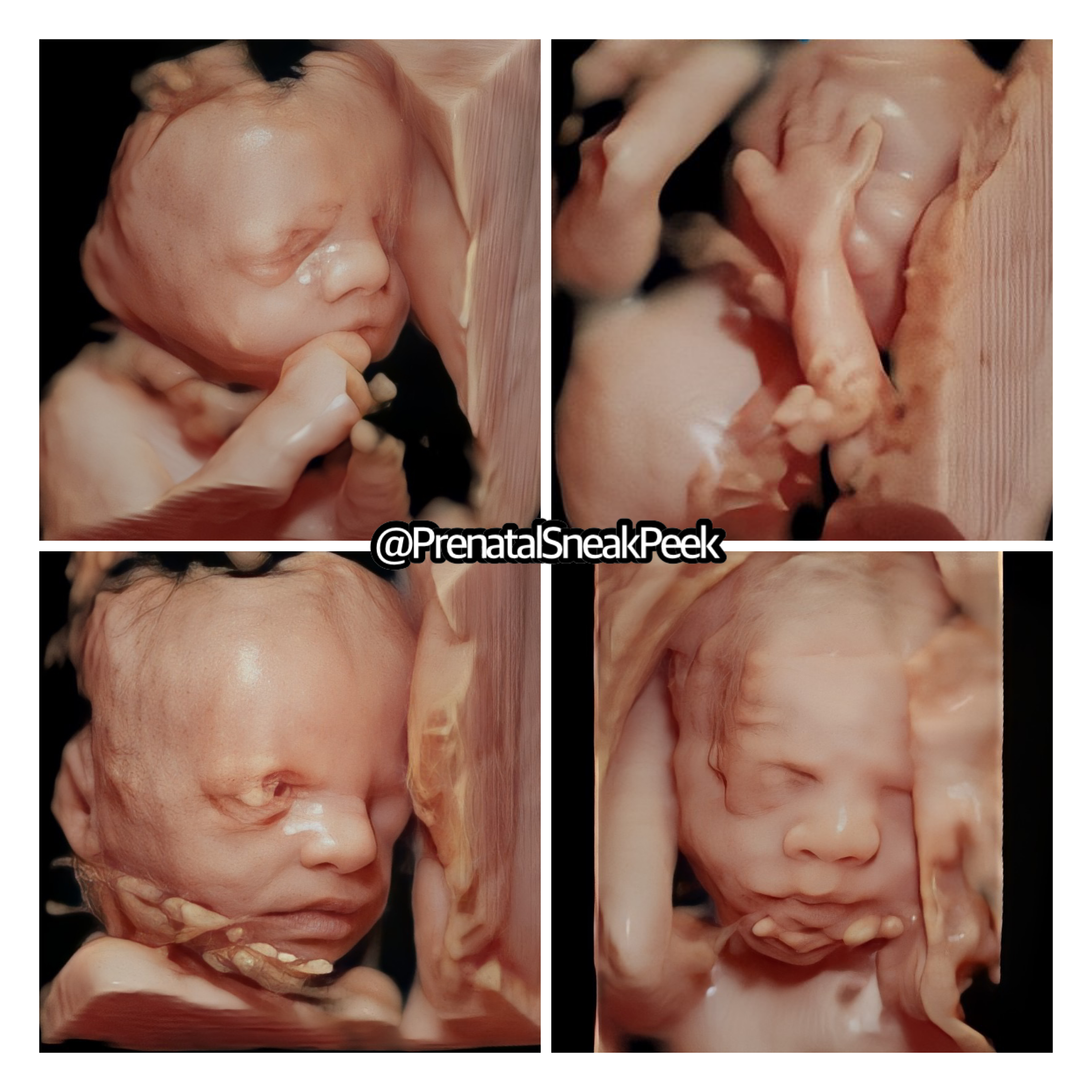 20220509_033140000_iOS