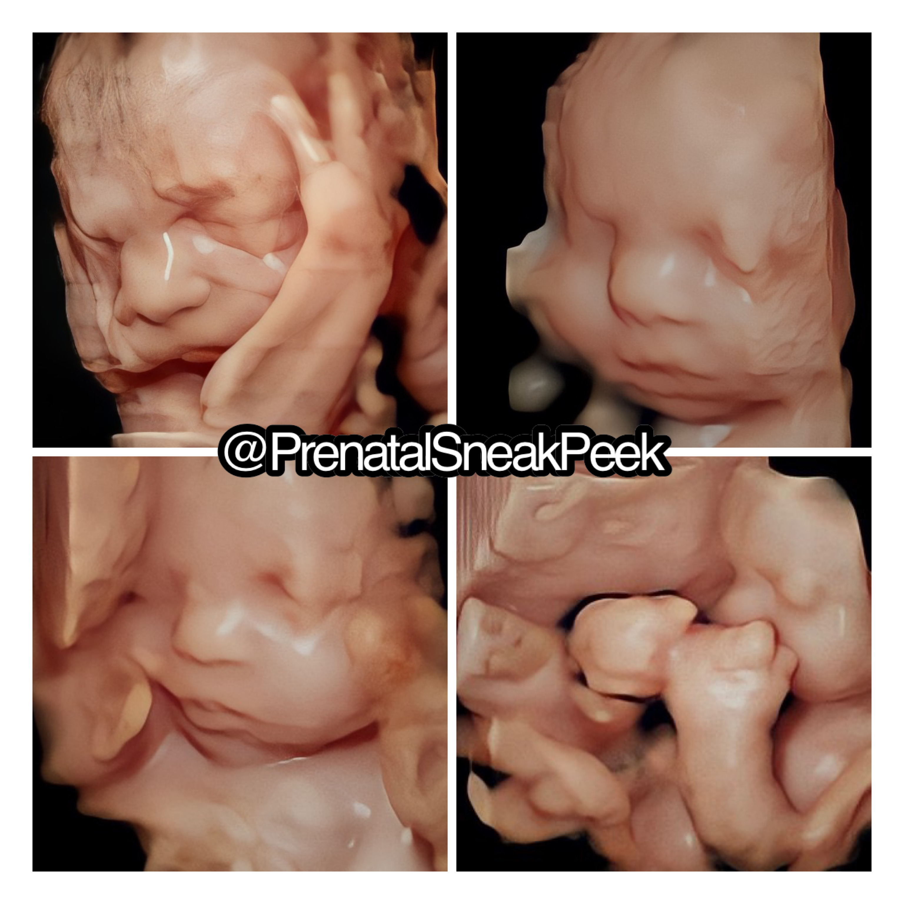 20220804_142326000_iOS