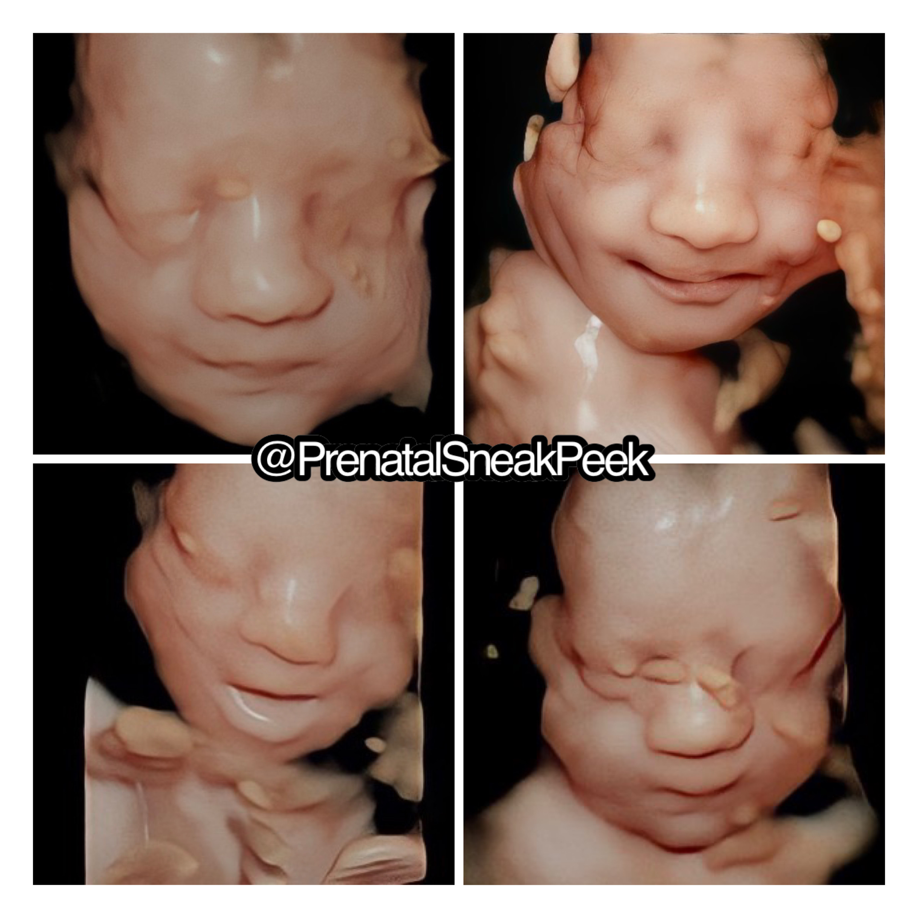 20220804_142612000_iOS